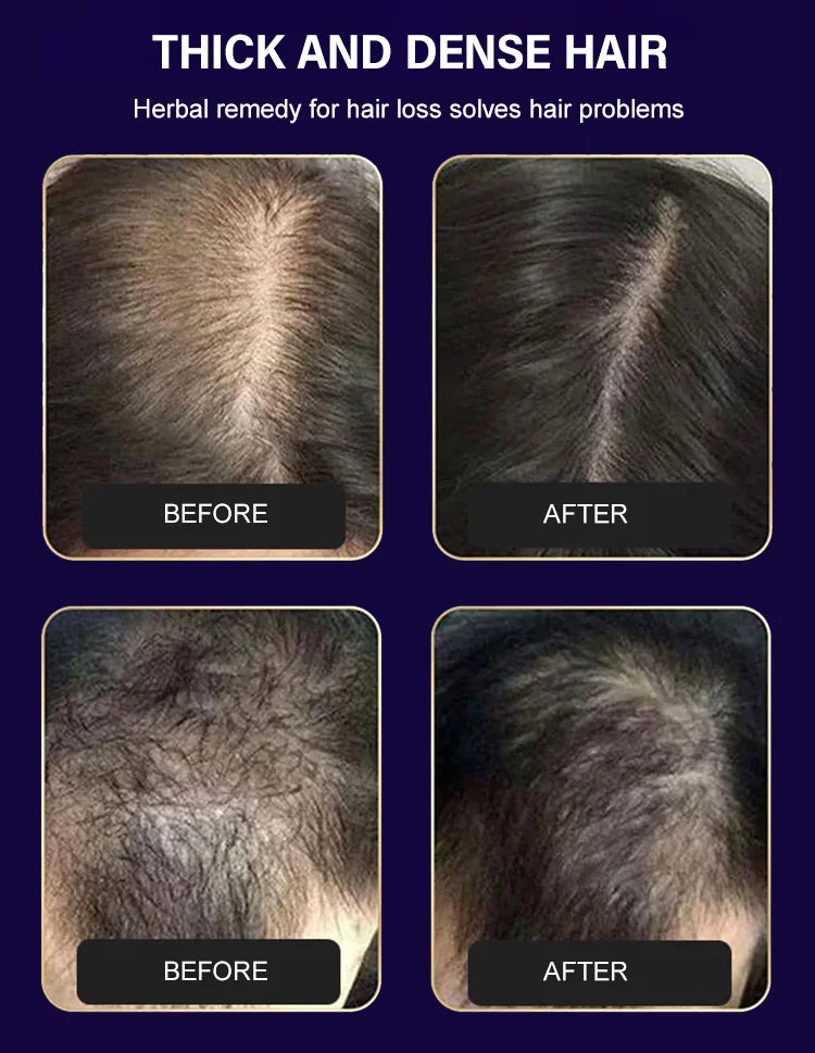 FEG Hair Growth