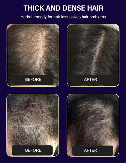FEG Hair Growth