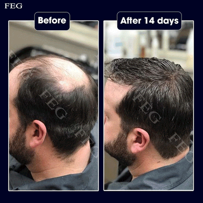 FEG Hair Growth
